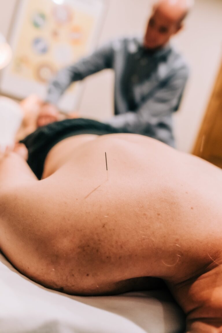 Acupuncture in Steamboat Springs