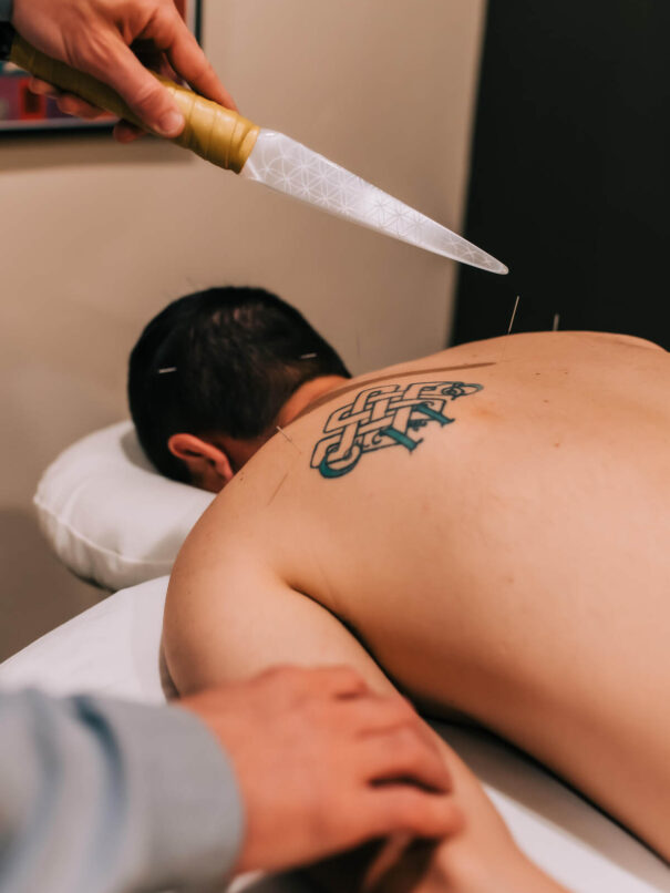 Esoteric Acupuncture